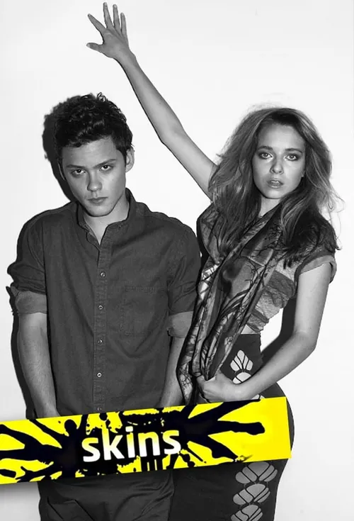 Skins UK